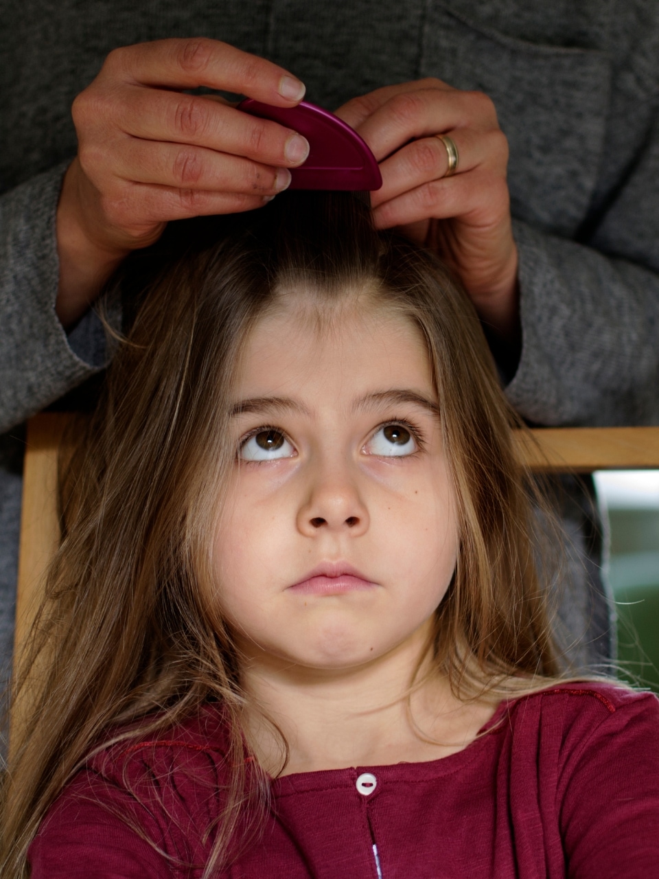 Understanding head lice causes, symptoms, and treatments for all ages