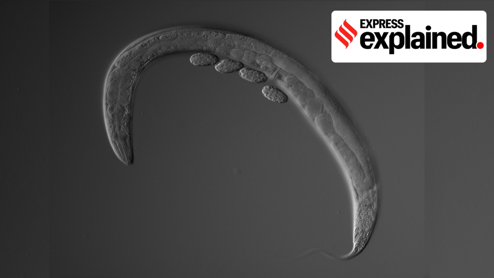 Simple microscopic worms, studying which has won scientists four Nobel Prizes so far