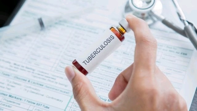 Global TB report shows India continues to have highest disease burden