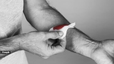 Can this gel-based solution stop excessive bleeding?