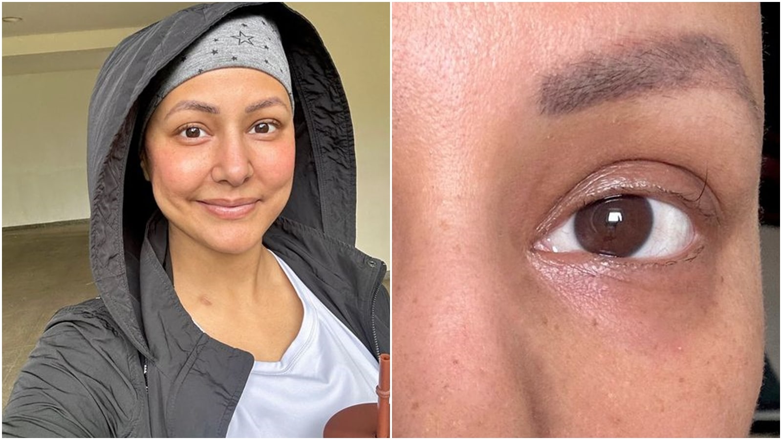 Hina Khan is nearing last cycle of chemotherapy, shares pictures of her  'last standing eyelash' | Television News - The Indian Express