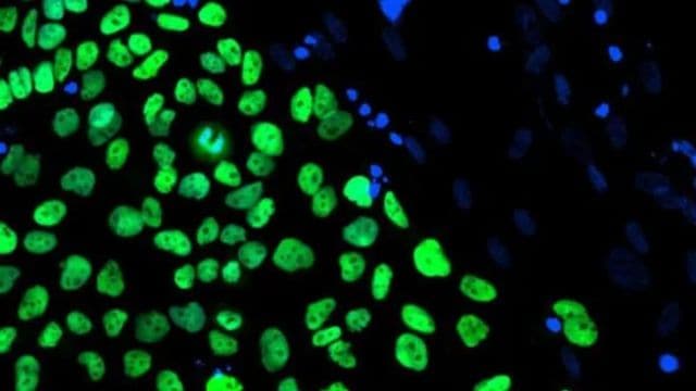 Stem cells are a peculiar   benignant   of cells that tin  differentiate into specialised cells. They person  to beryllium  programmed oregon  guided to make   into insulin- secreting pancreatic islet cells.