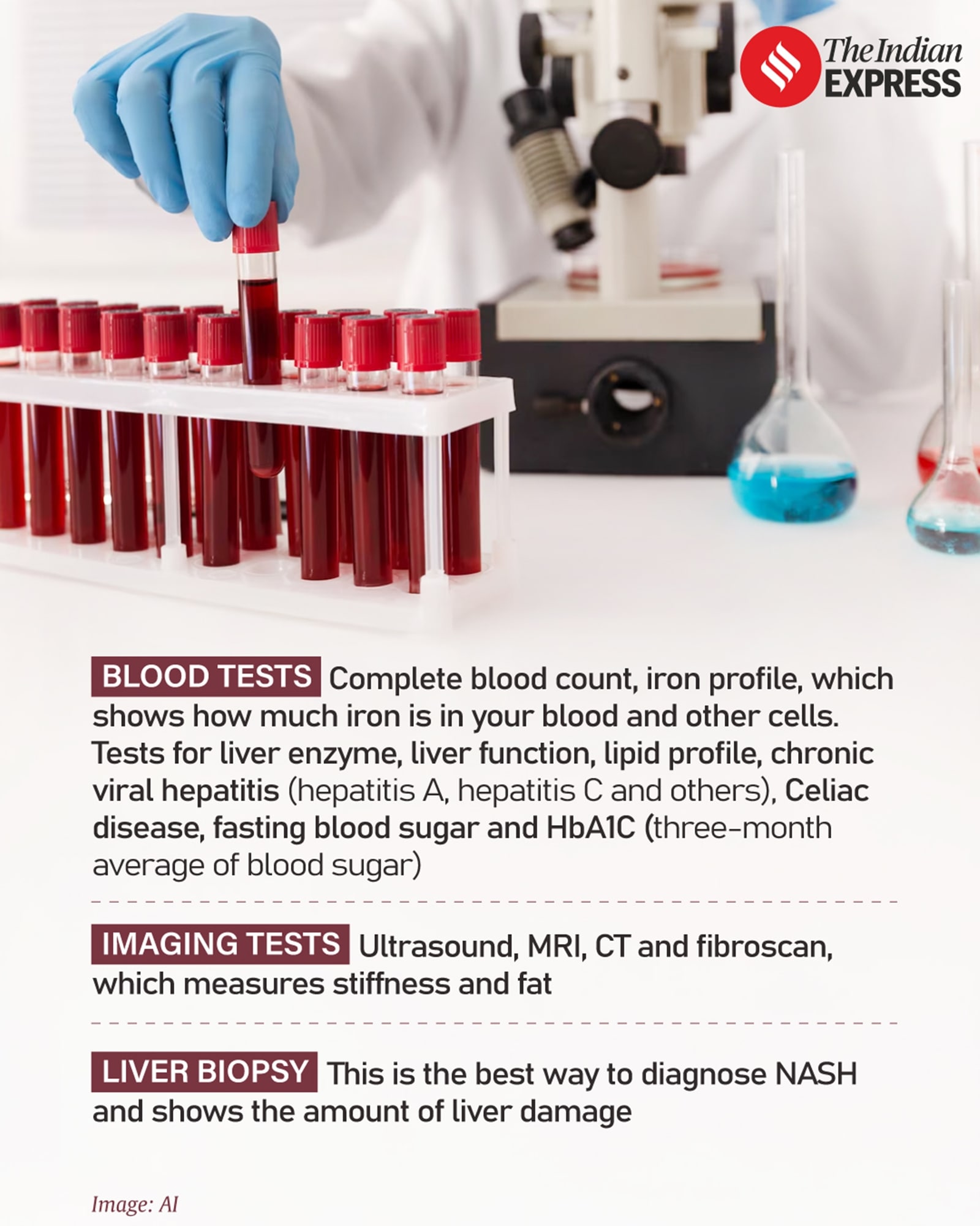 Why fatty liver is on the rise among young Indians? A 21yearold
