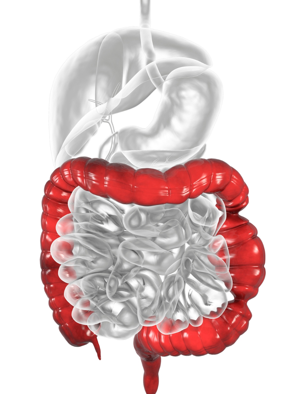 Managing IBS: Key foods to avoid for better gut health