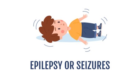 Seizures or fits