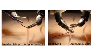 The da Vinci Surgical System robot learned and performed critical surgical tasks like needle manipulation, suturing, and lifting tissue. (Image: YouTube)