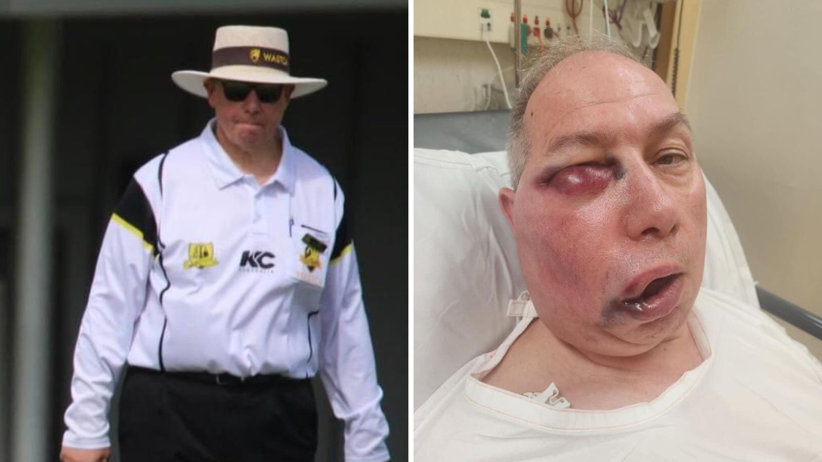 Australian cricket umpire suffers a brutal blow while officiating thumbnail