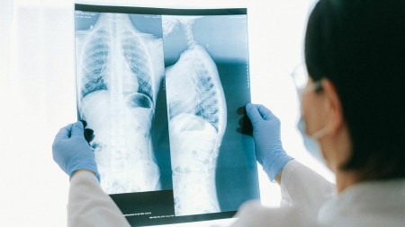 COPD flare-ups (also called exacerbations) can be deadly