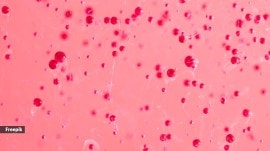 distinct pink colour, pink slime, bacteria, bathroom