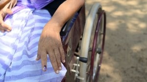 Persons with Disabilities, Disability