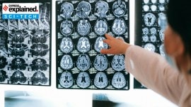 brain mapping