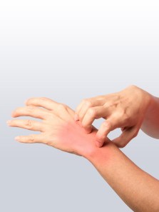 What triggers hand allergies and how to manage them effectively
