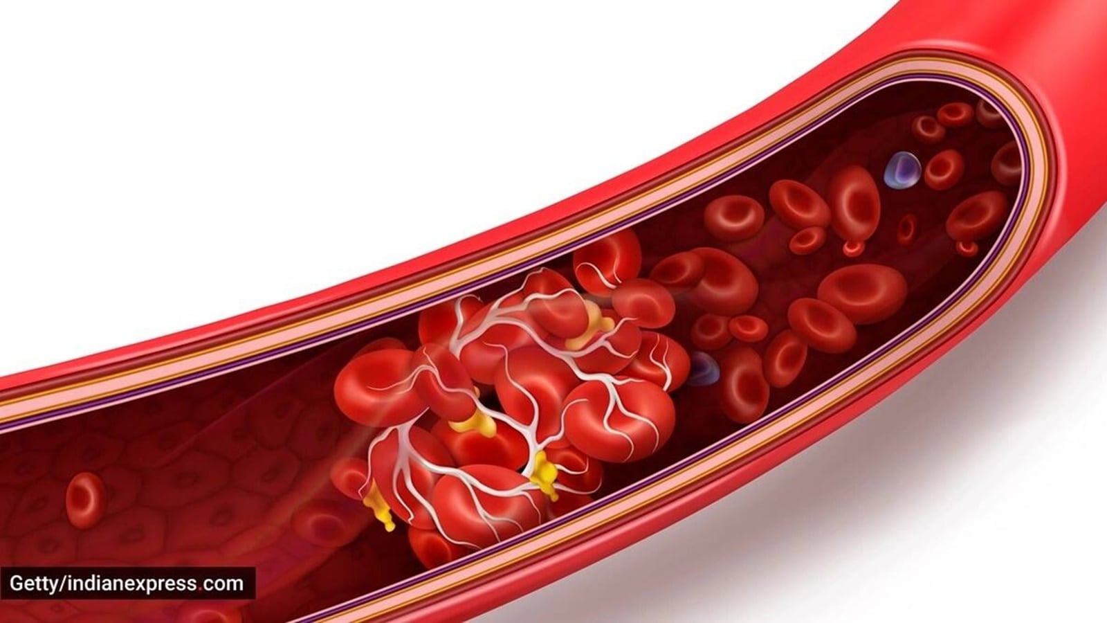 Vitamin B12 strips or tablets: Find out which one you should pick | Health News