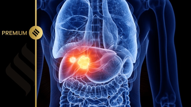 liver cancer, immunotherapy