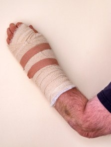 Do’s and don’ts of wrist surgery recovery