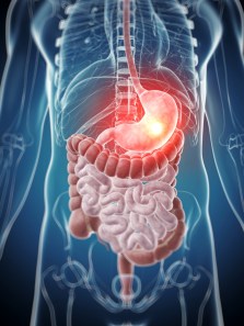 Should you eat curd on an empty stomach? Experts weigh in