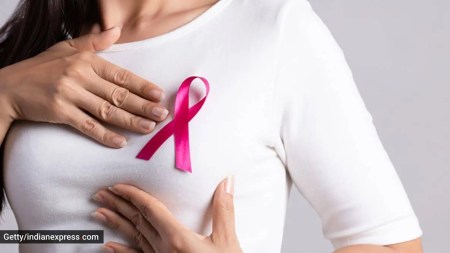 Globally, breast cancer is the most common cancer type among women and the second most common cancer type overall.