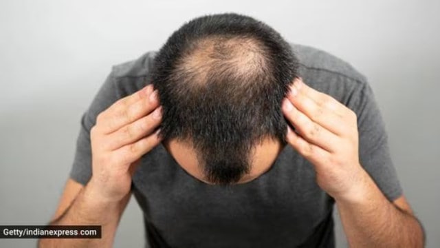 hair loss