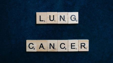 lung cancer, non smoking women