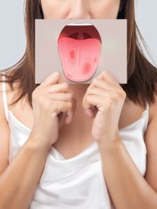 Cancer treatment and oral infections: Understanding the risks