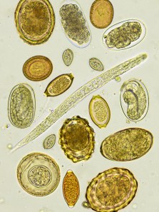 Parasites unveiled: Understanding the threat of worm infestations