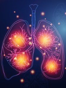 Could a fire damage your lungs forever?