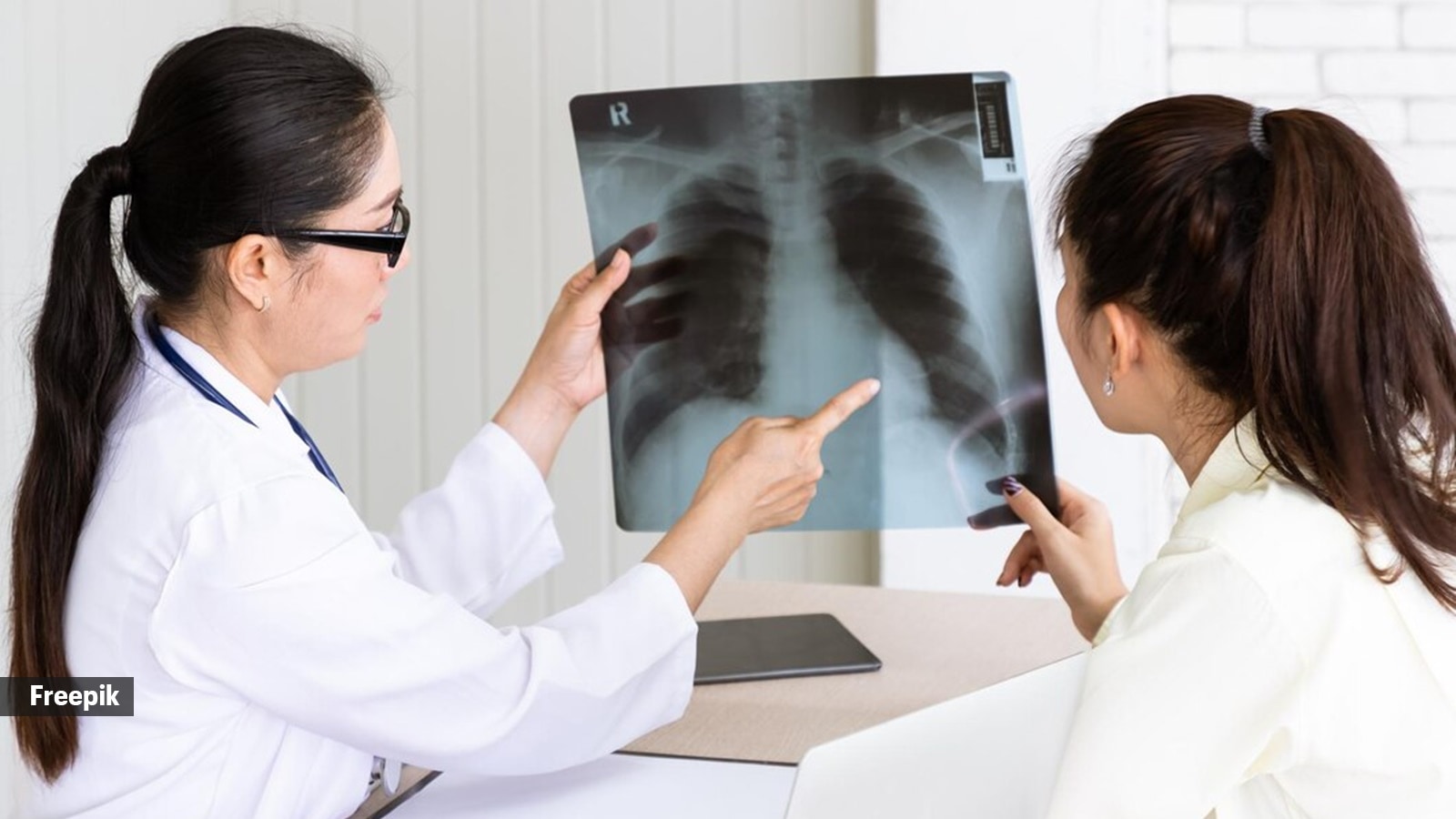 Why increasing rates of tuberculosis in UK, US should concern everyone