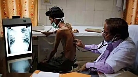 tuberculosis, treatment, indian express