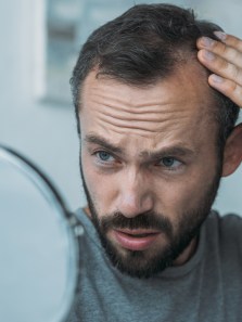 Understanding the link between diet, weight loss, and hair loss