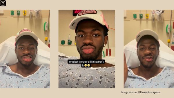Lil Nas X hasn’t revealed what exactly caused the condition, many fans have speculated it could be Bell’s palsy