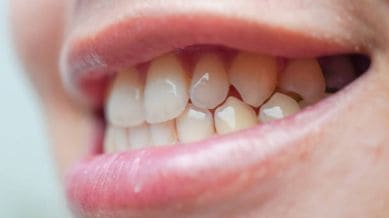 vampire teeth