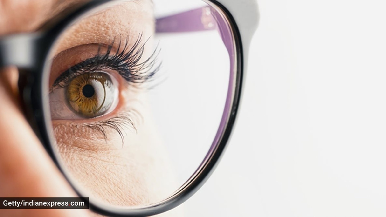 corneal damage