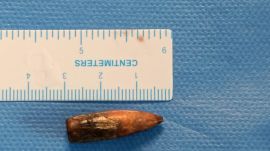 somalian man brain injury, hospital