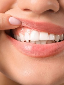 Why your gums are receding – And what to do about it