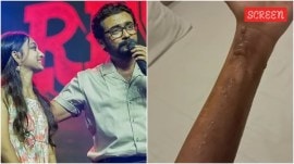 During the shooting of Suriya's Retro, Aavni Anjali Nair suffered burn injuries to her eyes, eyebrows, hair, ears and hands.