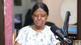 Kafi Acid Attack survivor Chandigarh
