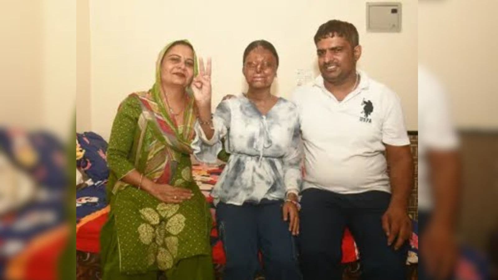 acid attack