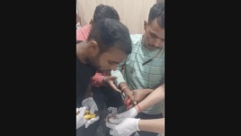 According to officials, the girl’s fingers, one on each hand, got stuck in a bench in the park.