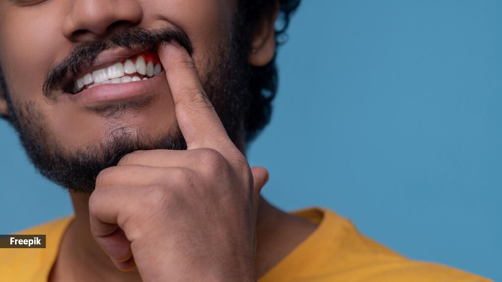 From vigorous brushing to clear aligners, here’s what might be causing your gums to recede