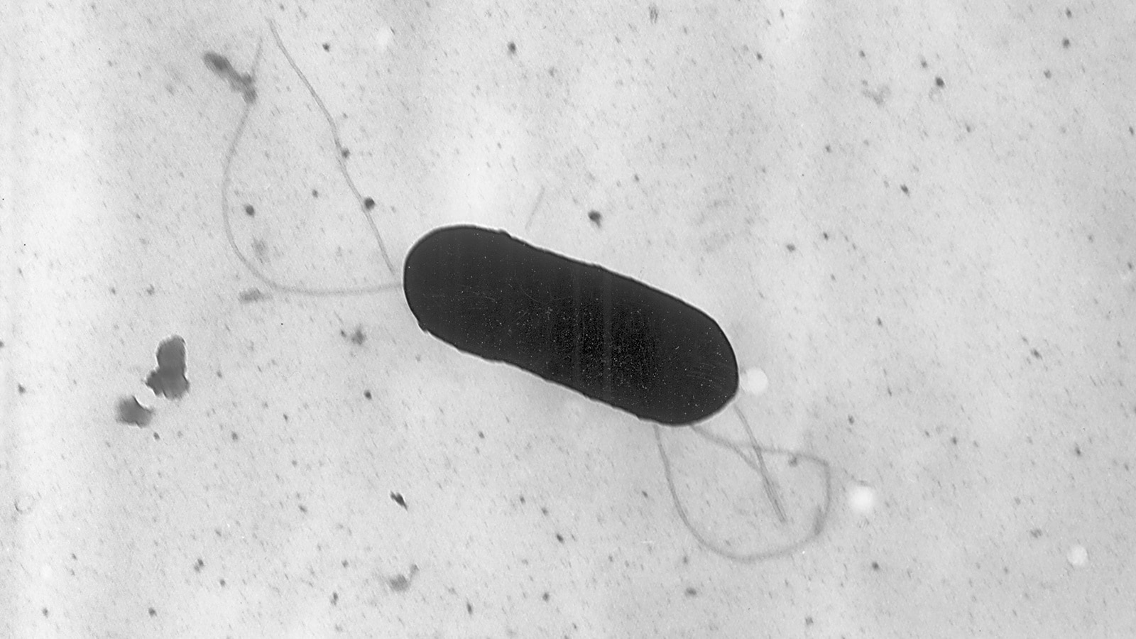 At least 10 people hospitalized in US due to listeria outbreak, FDA links it to prepared food | World News
