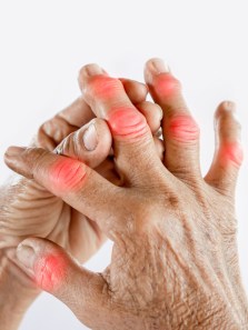 Mobile phone fingers: Causes, prevention and mental health effects explained