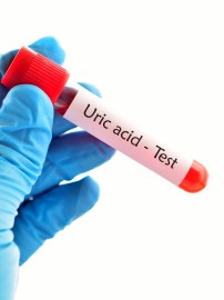 Lowering high uric acid in body