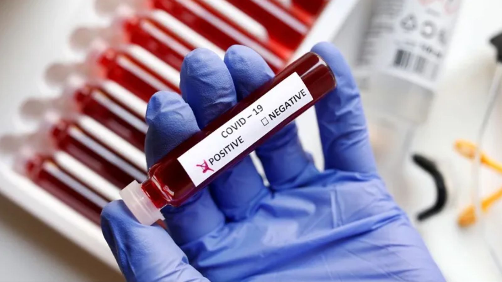 Manipur Confirms First COVID-19 Case in Current Wave