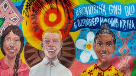 International Albinism Awareness Day 2025: Know the date, theme, history, and significance behind the day. (Photo: UNICEF)