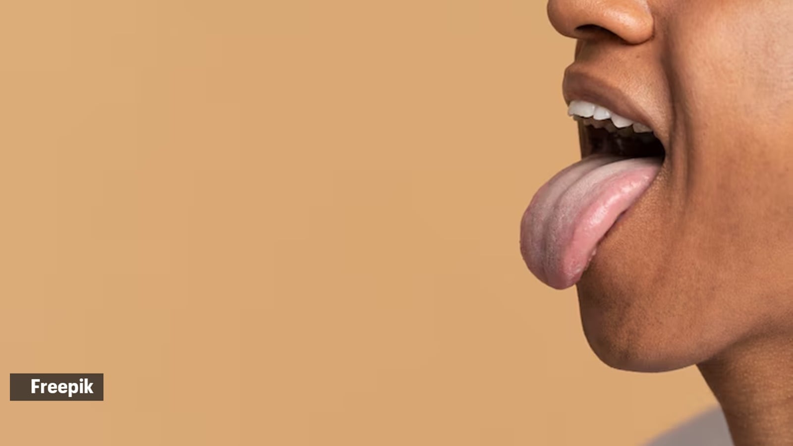 white tongue