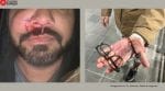 Indian-origin scientist beaten in Dublin Ireland racism