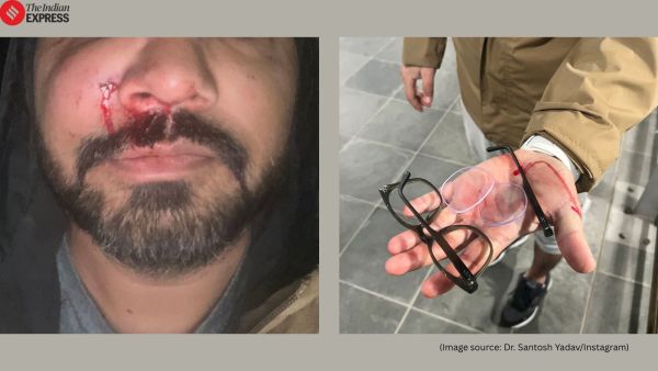 Indian-origin scientist beaten in Dublin Ireland racism