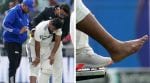 Rishabh Pant, who retired hurt on the first day of the Manchester Test, has been advised six weeks rest because of a toe fracture.