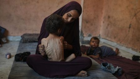 Naima Abu Ful holds her malnourished 2-year-old child, Yazan, at their home in the Shati refugee camp in Gaza City on Wednesday, July 23, 2025. (AP Photo)