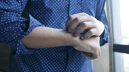 Fungal infection can manifest in several ways — itchy skin, rashes, discoloured nails and cough.